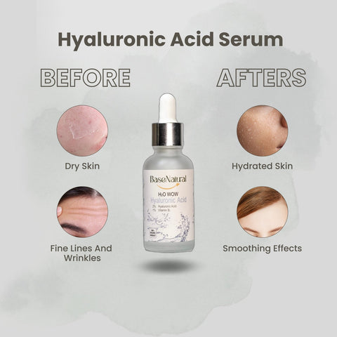 H2O Wow – Hyaluronic Acid