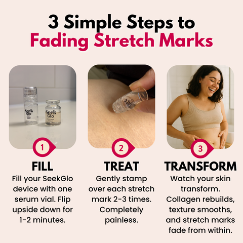SeekGlo Stretch Mark Serum