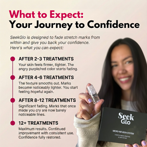 SeekGlo Stretch Mark Serum