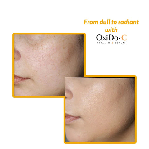 Pure Vitamin C Serum - 15ml